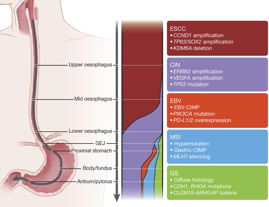 Illustration of an esophagus