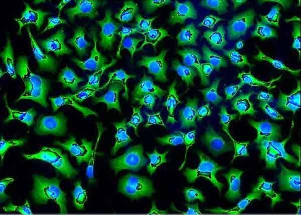 Small green shapes with blue centers fade into a black background. The green shapes are fairly dense and are sized similarly.