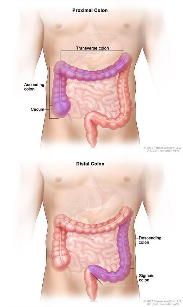 Two side-by-side illustrations about the colon. The top section, labeled "Proximal Colon," highlights the ascending colon, cecum, and transverse colon in purple on the left side of the body. The bottom section, labeled "Distal Colon," shows the descending colon and sigmoid colon in purple on the right side of the body. The colon is depicted within an outline of the human torso, showing its position relative to other internal organs.
