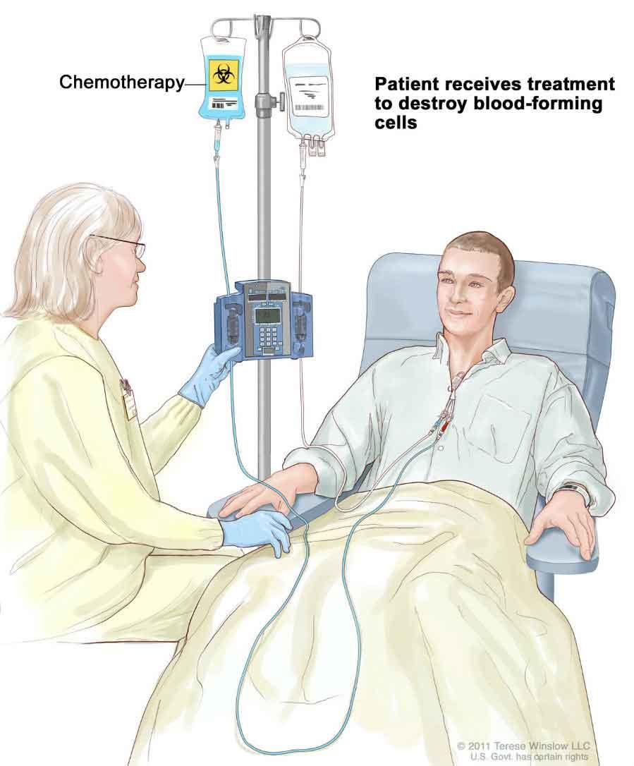Illustration of a medical professional giving a patient chemotherapy. Both are seated, with the medical professional in scrubs and gloves and the patient in a casual long sleeve shirt sitting in a chair. The machine has two IV bags and one is labeled “Chemotherapy.” On the opposite side of that machine text reads “Patient receives treatment to destroy blood-forming cells.”