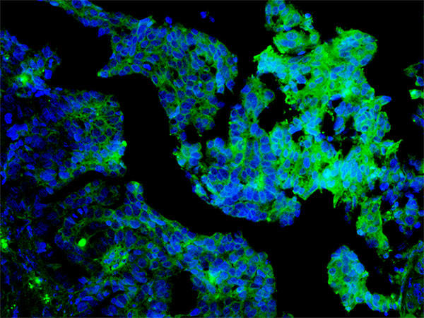 Blue and green stained human ovarian cells on a black background. The bottom left part of the image is mostly blue and black with some green highlights; moving to the top right, the cells increasingly become brighter and more green.