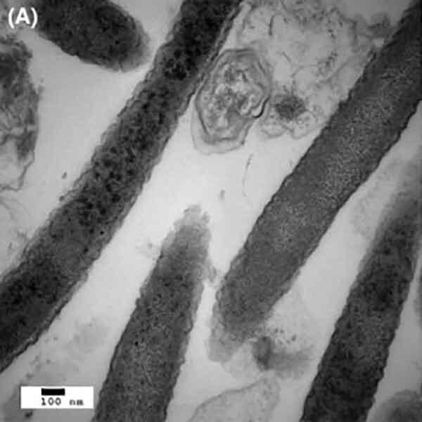 Electron micrograph of Fusobacterium nucleatum, a bacterium linked to colorectal cancer growth and spread.
