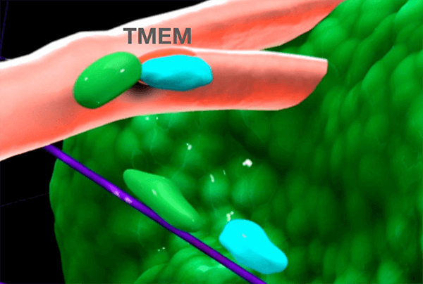 Illustration of TMEM chemo induced metastasis