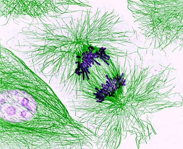 Magnified image showing cells during mitosis. Green filaments represent the cytoskeleton and spindle fibers, while clustered dark purple lines illustrate chromosomes lined up during cell division.