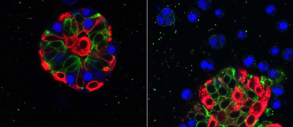 Two images show fluorescently colored cells under a microscope. On the left, a cluster with visible blue, red, and green components. On the right, the blue is dispersed while the red and green maintain their original form.