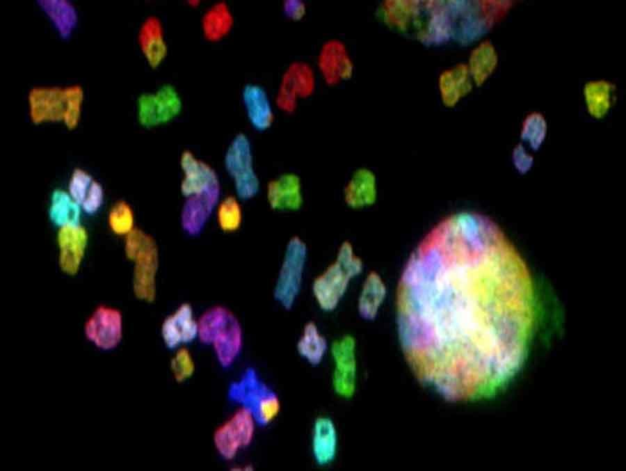 Microscopic image showing chromosomes extracted from glioblastoma cells.