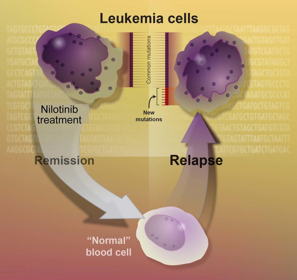 Illustration showing how nilotinib inhibits the BCR-ABL protein in chronic myeloid leukemia cells, leading to reduced cancer cell proliferation.
