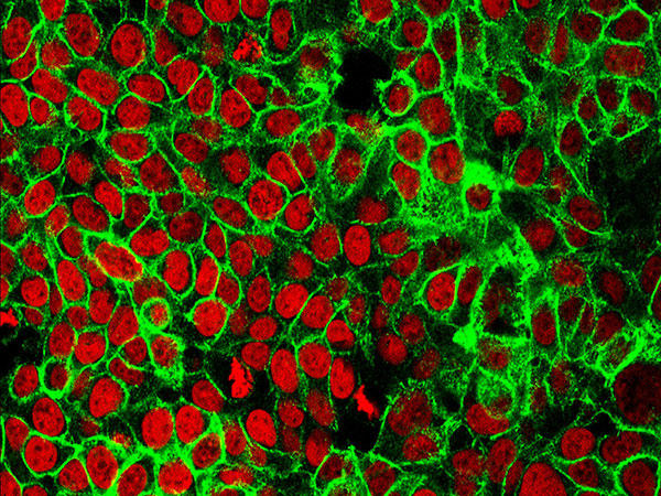 Red cells on a black background with neon green coloring between some of the cells.