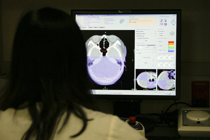 Medical professional reviewing brain scan images on computer screen to create a treatment plan for a brain tumor patient, with the colorized scan showing brain anatomy in purple and white.