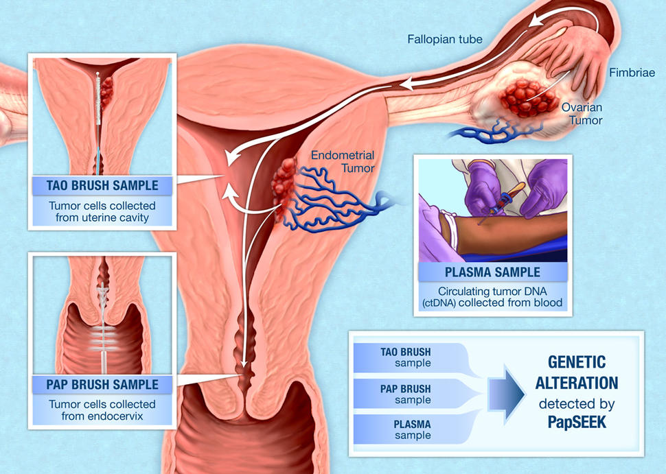 Illustration of how PapSEEK detects genetic alterations in endometrial and ovarian cancers using samples from Tao brush, Pap brush, and blood plasma.