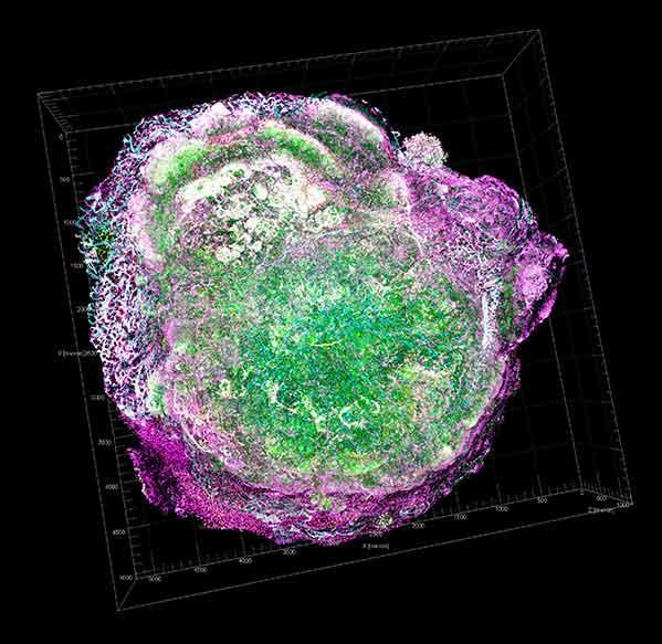 3D visualization of a single breast cancer cell and its microenvironment using transparent tumor tomography, showing cellular structures in green and purple within a wireframe display grid