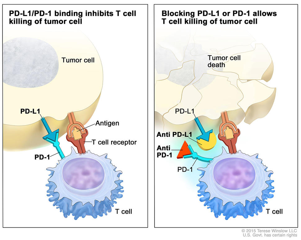 Two-panel illustration showing the interaction between T cells and tumor cells. The left panel is titled "PD-L1 binds to PD-1 and inhibits T cell killing of tumor cell" and shows an antigen and T cell receptor, illustrating the inhibition of T cell activity. The right panel is titled "Blocking PD-L1 or PD-1 allows T cell killing of tumor cell" and shows tumor cell death, indicating successful T cell activity.