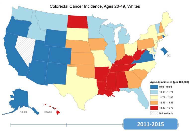 U.S. map illustrates colorectal cancer incidence rates among white individuals aged 20-49 from 2011 to 2015. States are color-coded based on age-adjusted incidence per 100,000: light yellow for 9.03-10.98, light blue for 10.99-11.71, light orange for 11.72-12.55, dark blue for 12.56-13.48, and red for 13.49-15.73. Stripes indicate unavailable data.