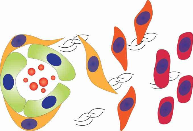 Diagram illustrating tumor cell progression from a primary site (left) through migration (center) to distant metastasis (right), representing the formation of a pre-metastatic niche.