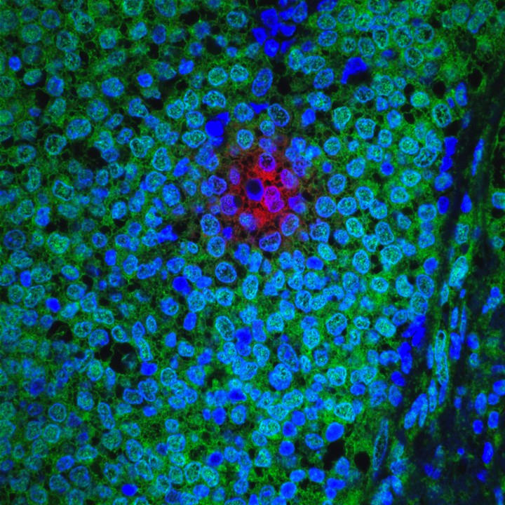 Fluorescent microscopy image of tissue showing a dense arrangement of cells. The cells are stained with various colors: bright blue, green, and a prominent cluster of red near the center. The vibrant colors highlight different cellular components or markers, providing insight into the tissue's structure and function.