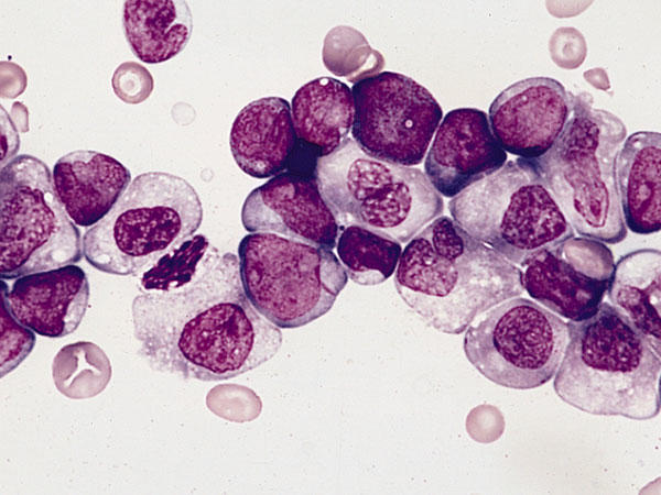 A group of purple cells adjacent to each other. Some cells have a larger, clear membrane.