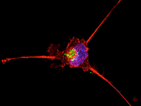 A vivid microscopy image of a single cell on a black background. The cell features a bright blue nucleus with green spots inside it, surrounded by red extensions that spread outwards. 