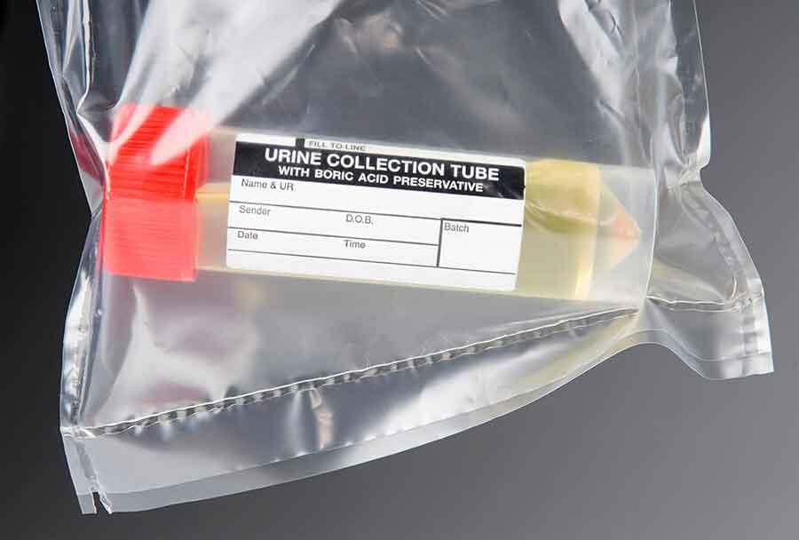 Urine collection sample inside a sealed plastic bag.