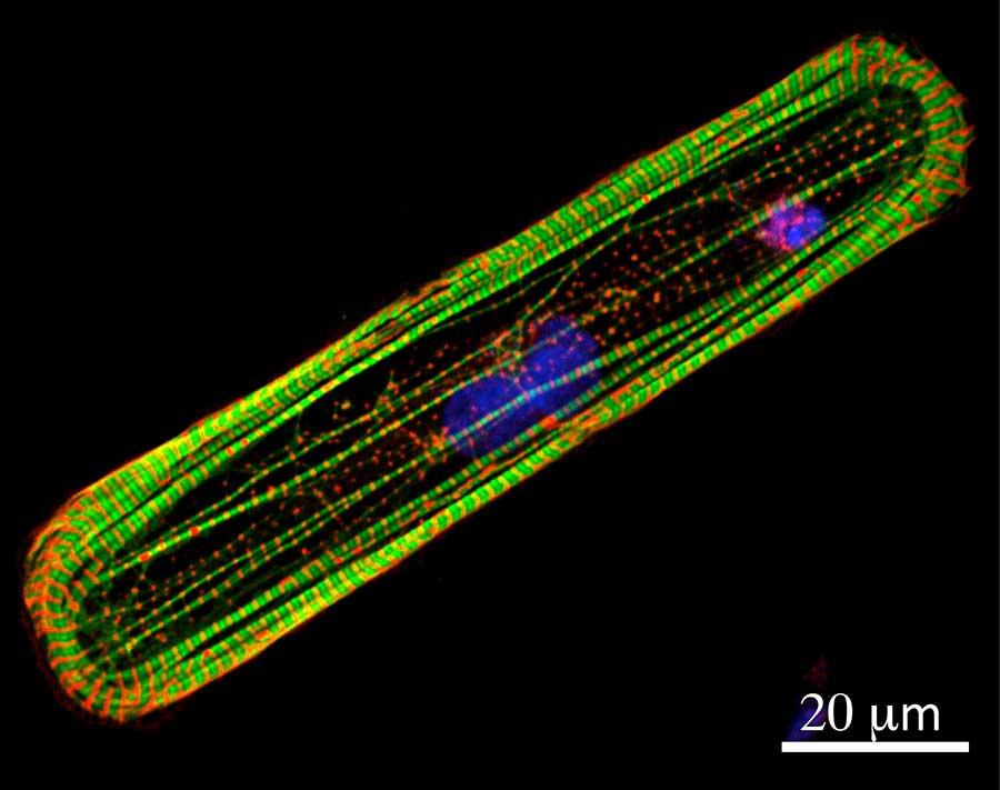 Microscopic image of stem cell-derived heart muscle cell. 