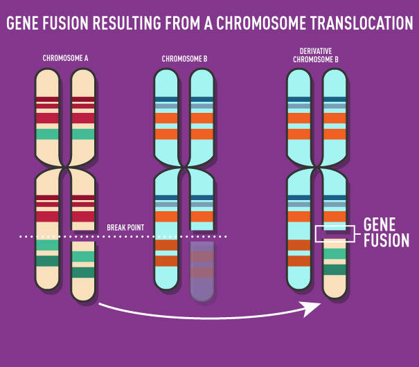 Image of three sets of chromosomes with gene fusion resulting from a chromosome translocation.