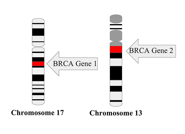 Illustration of BRCA Gene 1 (chromosome 17) and BRCA Gene 2 (chromosome 13)