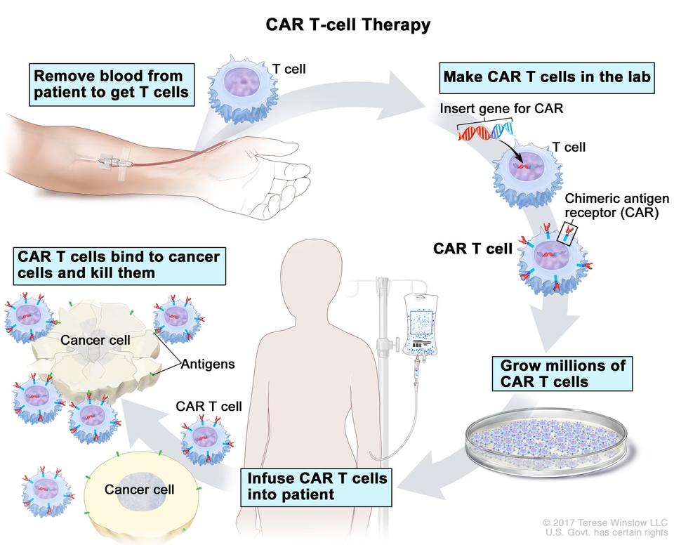 Illustration of CAR T-cell Therapy. The process begins with blood removal from a patient to isolate T cells. In the lab, a gene for a Chimeric Antigen Receptor (CAR) is inserted into T cells, creating CAR T cells. These cells are then grown in the millions. The CAR T cells are infused back into the patient, where they bind to cancer cell antigens and kill the cancer cells. Arrows connect the stages of the therapy in the order described.