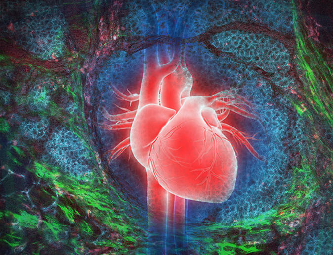 An illustration of an anatomical heart over top of breast cancer cells.