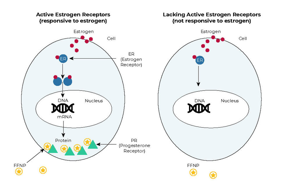 Illustration comparing two cells: one with active estrogen receptors (left) and one lacking them (right). The left cell shows estrogen binding to receptors, leading to DNA interaction and protein production, including progesterone receptors. The right cell, without active receptors, shows no such activity.