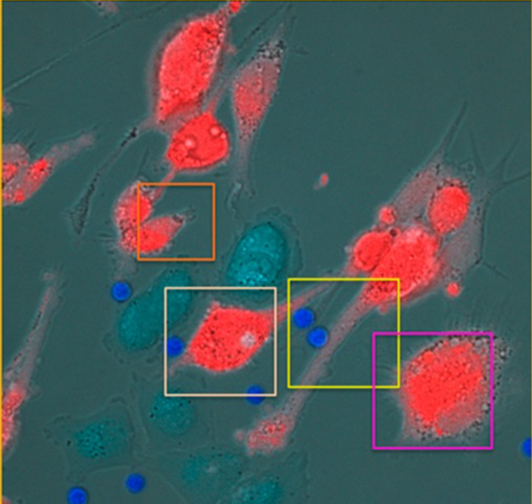 Microscopic image of stained cells with red and blue highlights. Different areas are outlined with colored boxes.