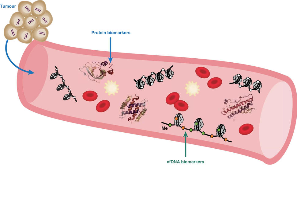 Illustration depicting biomarkers in the bloodstream related to a tumor. The cross-section of a blood vessel shows various elements, including red blood cells, protein biomarkers, and circulating free DNA (cfDNA) biomarkers. An arrow points from a cluster of tumor cells into the blood vessel. Another arrow highlights cfDNA biomarkers with a label "Me," indicating methylation.