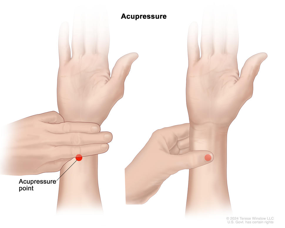 Illustration showing the location of an acupuncture point on the wrist and how to find it.