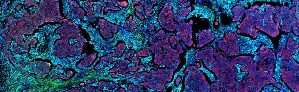 Imaging Mass Cytometry