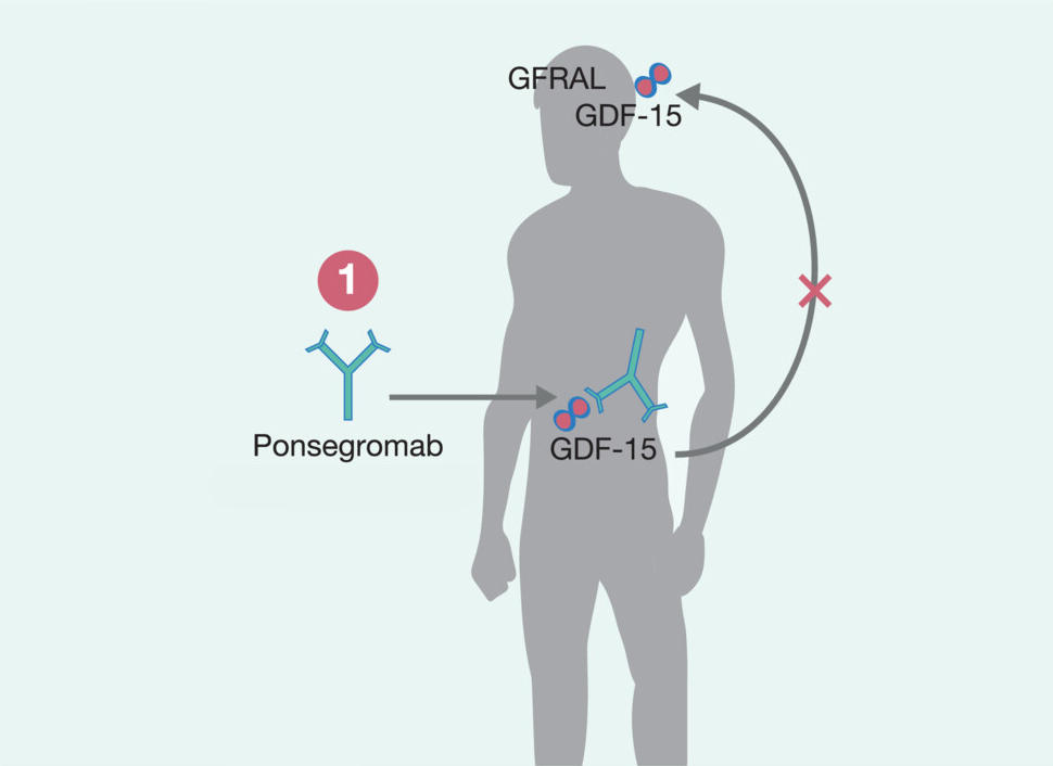 Silhouette of a human body showing Ponsegromab's biological mechanism of action.