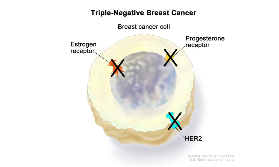 Drawing showing a triple-negative breast cancer cell with the estrogen receptor, progesterone receptor, and HER2 proteins crossed out with a black "X" mark. This means that the breast cancer cell does not have these proteins.