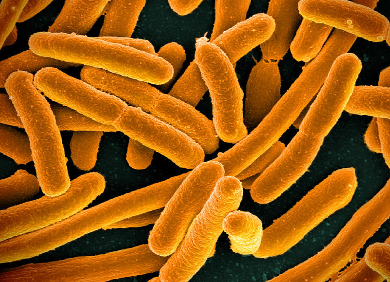 A scanning electron micrograph of E. coli, with the rod-shaped bacteria colored a mustard yellow.