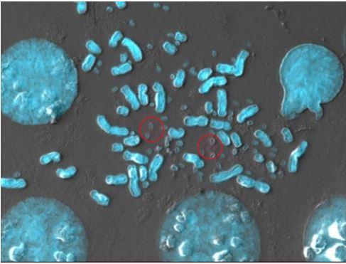 Cellular level imaging of a tissue sample shows many ecDNAs in and about chromosomes.