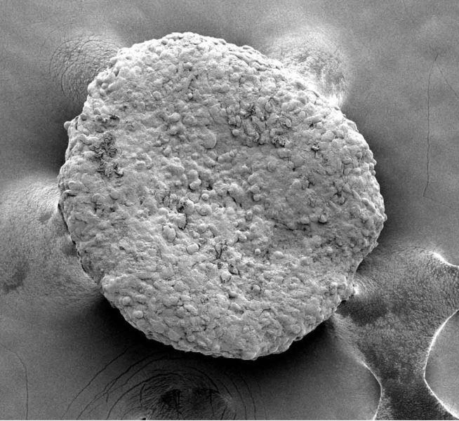 An electron microscope image showing a round, pocked clump of engineered beige fat cells.