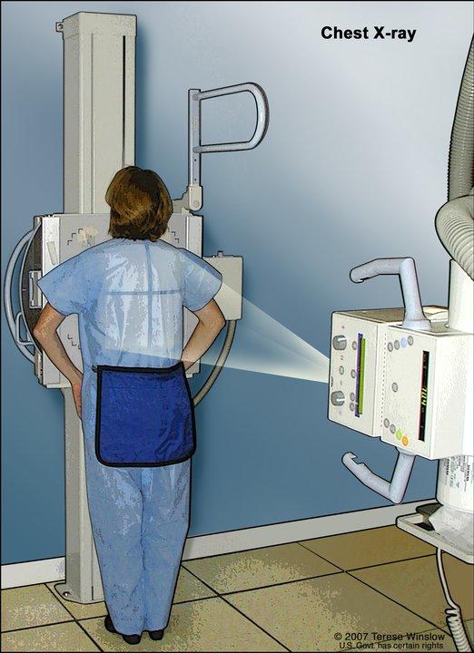 Drawing shows a patient standing with their back to the x-ray machine. X-rays pass through the patient's body onto film or a computer and take pictures of the structures and organs inside the chest.