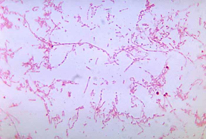 A microscopic view of Fusobacterium necrophorum. The bacteria is colored reddish pink, is thin and has various lengths - some fairly short, others quite long.