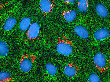 Fluorescence microscopy image of cells showing blue-stained cell nuclei surrounded by a network of green cytoskeletal filaments (likely actin or microtubules). Small red dots are visible between some of the cells.