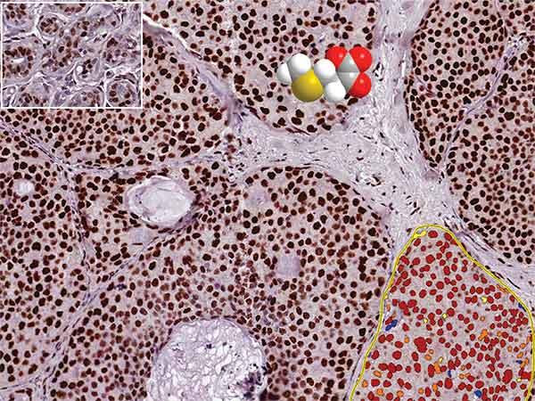 A computer generated image of a small molecule drug sits on top of a microscopically enlarged view of cells.