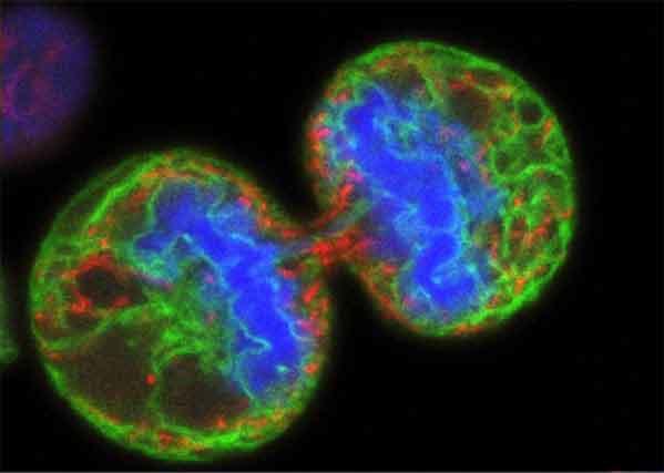 Microscope image showing two dividing melanoma cancer cells in vibrant colors - blue centers surrounded by green and red patterns - being targeted by T-VEC oncolytic virus therapy.