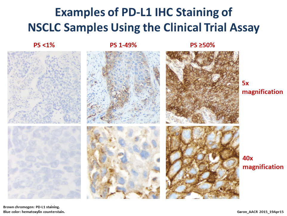 Staining slide showing range of PD-L1 expression in non-small cell lung carcinoma. There are three categories - PS <1%, PS 1-49%, and PS >= 50% - along with two magnifications, 5x and 40x. The images are fainter in the PS <1% column, and get darker and more detailed in the PS >= 50% column.