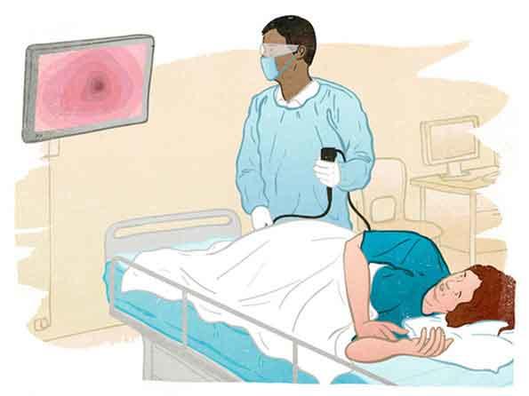 An illustration of a female patient receiving a sigmoidoscopy from a male doctor. The patient is lying on her side on a hospital bed, wearing a blue top and covered with white sheet. The doctor wears safety goggles, blue facemark, and blue scrubs with white gloves. He holds the controller in his hand. He looks at a screen that shows the inside of the colon.