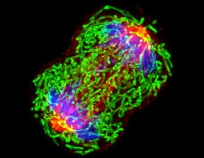 Una célula de cáncer de seno (mama) que se multiplica.