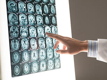 Series of brain scan images on a lightbox