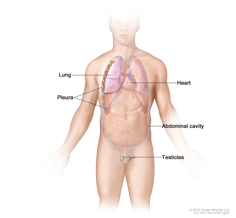 Malignant mesothelioma forms in the thin layer of tissue that covers the lung, chest wall, abdomen, heart, or testicles.