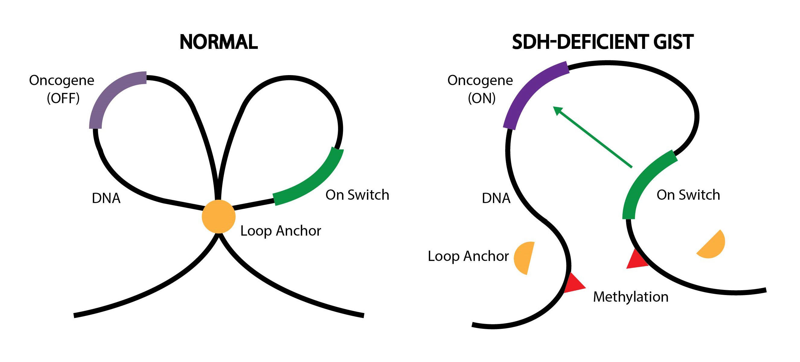 Epigenetic Changes Pinpointed as Cause of Some GISTs