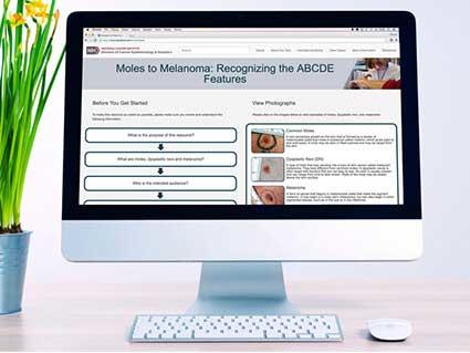 Desktop computer displaying a medical education website about "Moles to Melanoma: Recognizing the ABCDE Features" with interactive questions on the left and medical photographs on the right, shown next to a small potted plant.