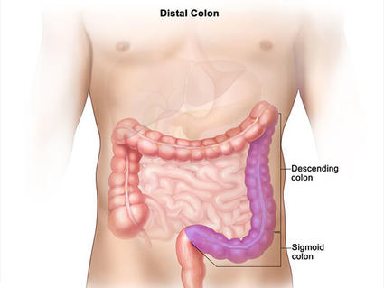 Two side-by-side illustrations about the colon. The top section, labeled "Proximal Colon," highlights the ascending colon, cecum, and transverse colon in purple on the left side of the body. The bottom section, labeled "Distal Colon," shows the descending colon and sigmoid colon in purple on the right side of the body. The colon is depicted within an outline of the human torso, showing its position relative to other internal organs.